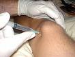 Knee Injection