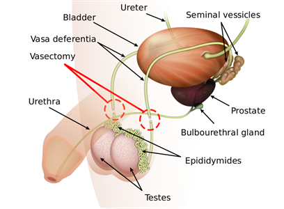 reduce cumshot vascectomy Does